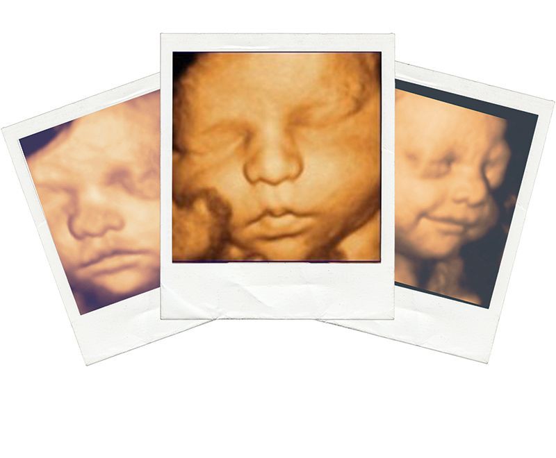 Image Gallery | Little Bellies Ultrasound 2D/3D/4D - 5D/HD & Pregnancy Spa