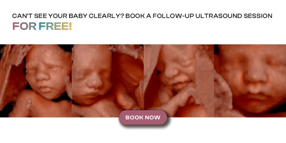 Los Angeles - Little Bellies Ultrasound 2D/3D/4D - 5D/HD & Pregnancy Spa